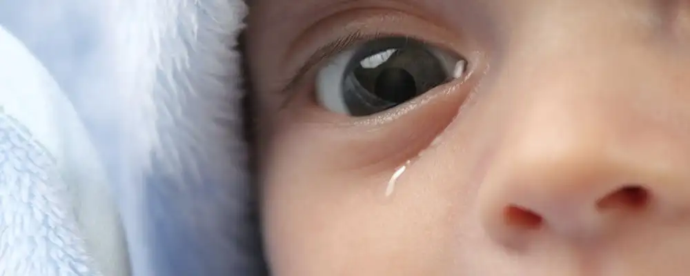 انسداد مجاری اشک در کودکان