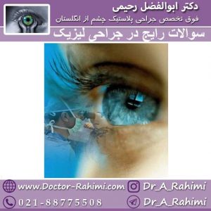 سوالات رایج در جراحی لیزیک