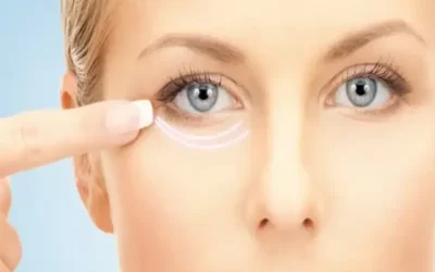 بهترین روش کاهش ورم بعد از بلفاروپلاستی چیست؟