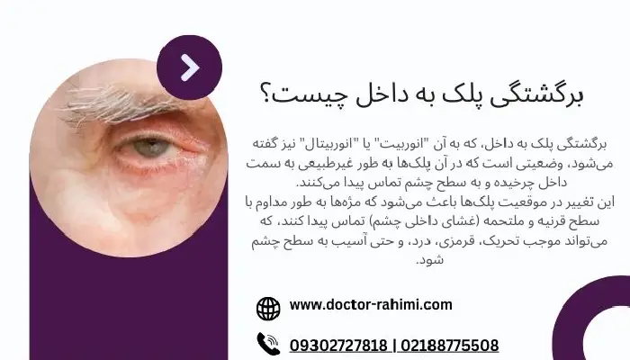 برگشتگی پلک به داخل