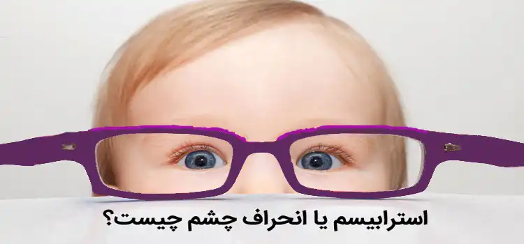 استرابیسم چیست