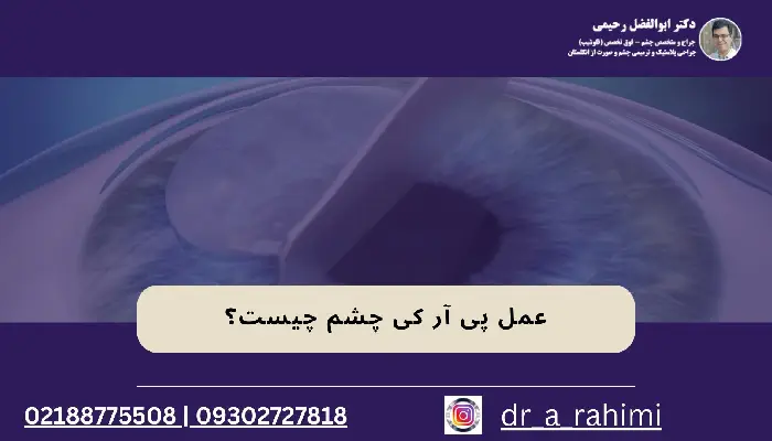 عمل پی آر کی چشم