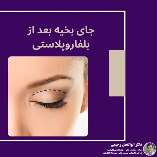 جای بخیه بعد از بلفاروپلاستی