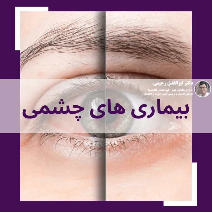 بیماری های چشمی