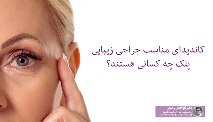 کاندیدای جراحی پلک چه کسانی هستند؟