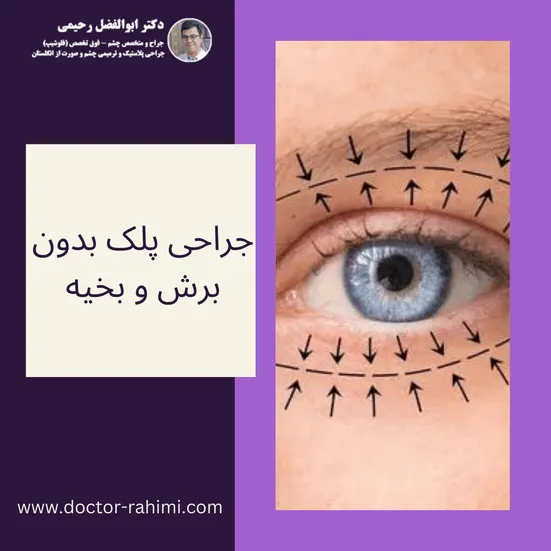 جراحی پلک بدون برش و بخیه