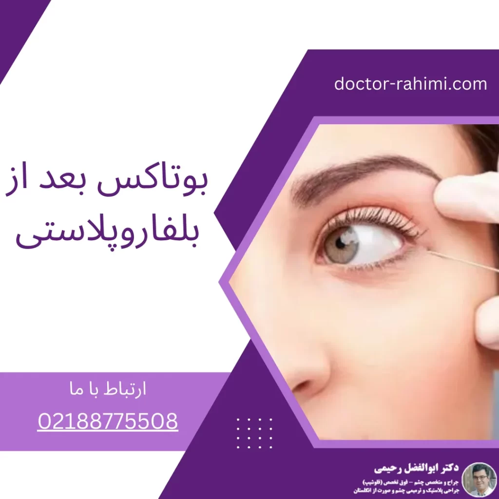 بوتاکس بعد از بلفاروپلاستی
