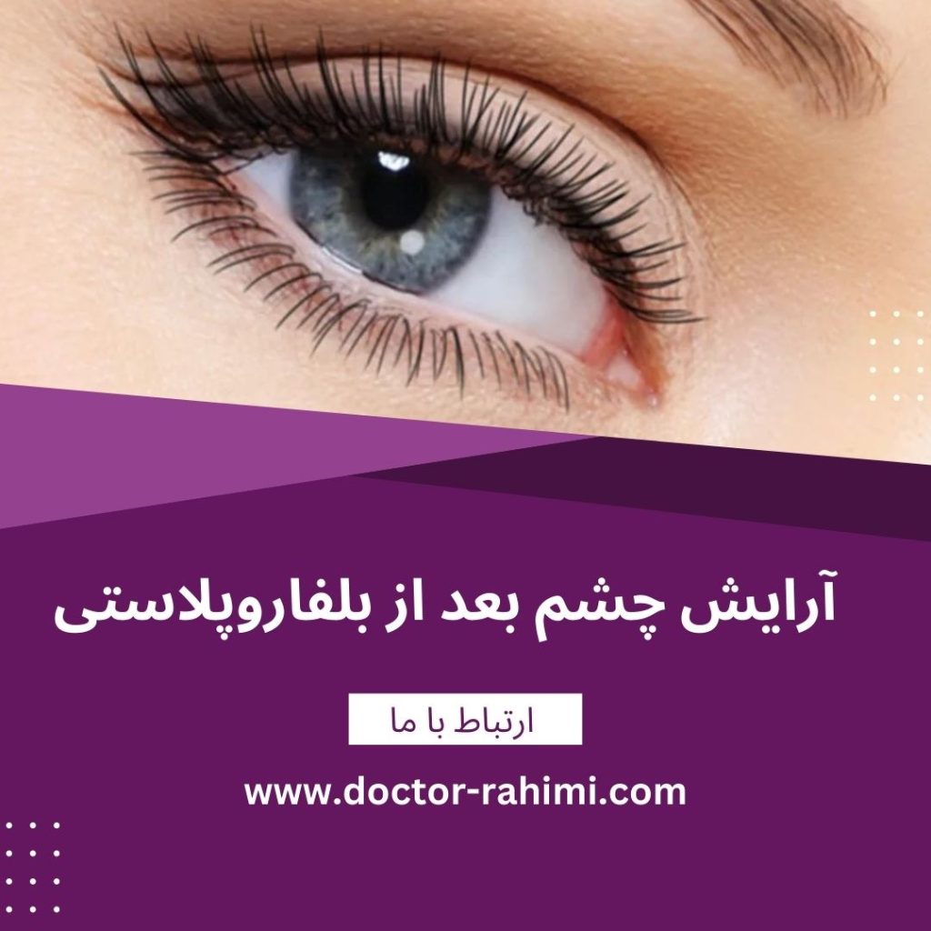 آرایش چشم بعد از بلفاروپلاستی