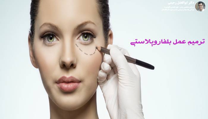 ترمیم عمل بلفاروپلاستی