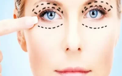 عوارض جراحی پلک چیست؟ راهنمایی جلوگیری