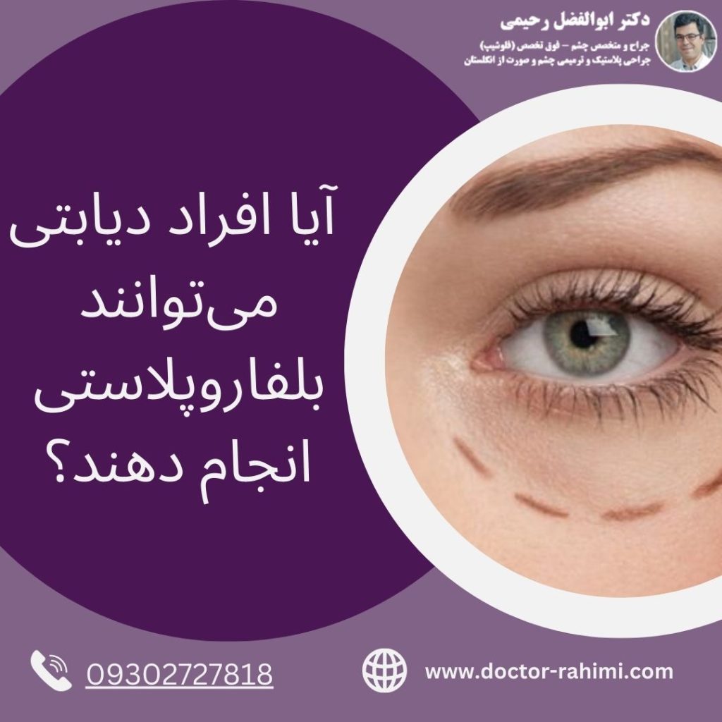 بلفاروپلاستی افراد دیابتی