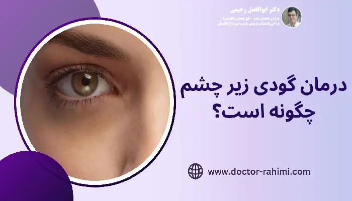 درمان گودی زیر چشم