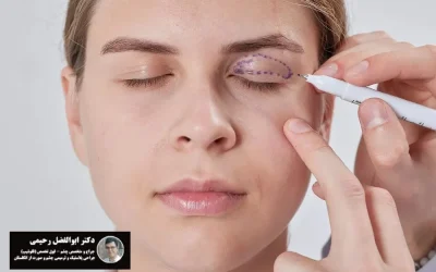 بلفاروپلاستی با لیزر چیست؟ کدام روش بهتر است