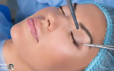 مراحل بلفاروپلاستی: راهنمای جامع عمل زیبایی پلک