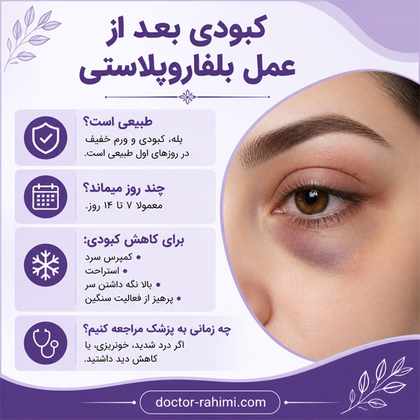 کبودی بعد از عمل بلفاروپلاستی - دکتر رحیمی